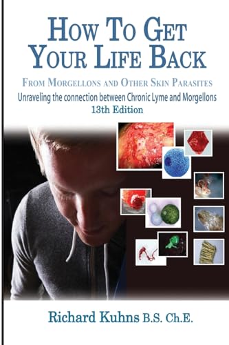 How to Get Your Life Back From Morgellons and Other Skin Parasites Limited Edit
