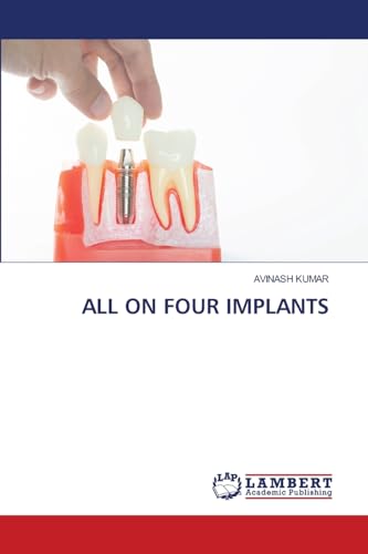 ALL ON FOUR IMPLANTS: DE von LAP LAMBERT Academic Publishing