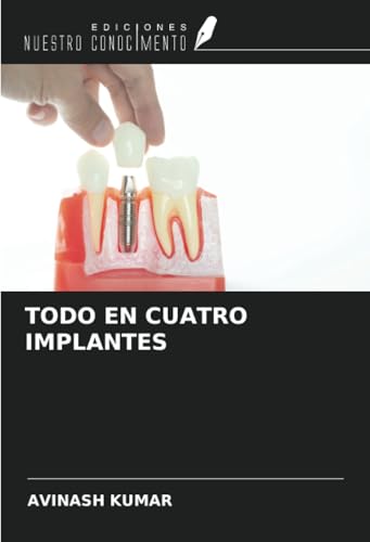 TODO EN CUATRO IMPLANTES von Ediciones Nuestro Conocimiento