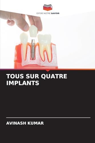 TOUS SUR QUATRE IMPLANTS: DE von Editions Notre Savoir