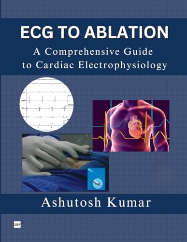 ECG TO ABLATION: A COMPREHENSIVE GUIDE TO CARDIAC ELECTROPHYSIOLOGY ECG TO ABLATION: A COMPREHENSIVE GUIDE TO CARDIAC ELECTROPHYSIOLOGY von Gurucool Publishing