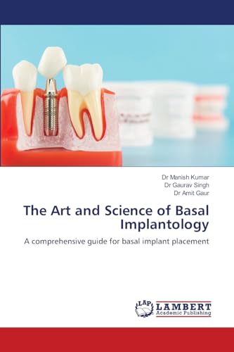 The Art and Science of Basal Implantology: A comprehensive guide for basal implant placement von LAP LAMBERT Academic Publishing
