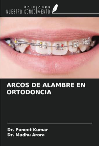 ARCOS DE ALAMBRE EN ORTODONCIA von Ediciones Nuestro Conocimiento