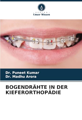 BOGENDRÄHTE IN DER KIEFERORTHOPÄDIE von Verlag Unser Wissen