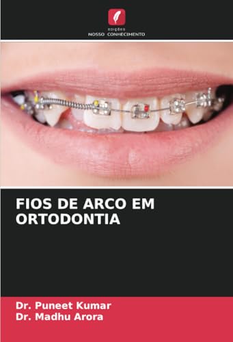 FIOS DE ARCO EM ORTODONTIA von Edições Nosso Conhecimento