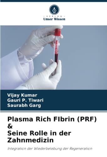 Plasma Rich FIbrin (PRF) & Seine Rolle in der Zahnmedizin: Integration der Wiederbelebung der Regeneration