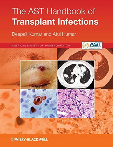 The AST Handbook of Transplant Infections The AST Handbook of Transplant Infections