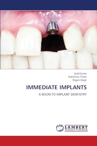 IMMEDIATE IMPLANTS: A BOON TO IMPLANT DENTISTRY von LAP LAMBERT Academic Publishing
