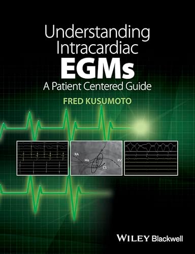 Understanding Intracardiac EGMs: A Patient Centered Guide von Wiley
