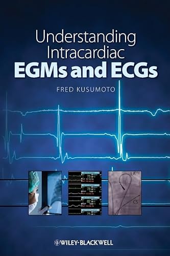 Understanding Intracardiac EGMs and ECGs von Wiley