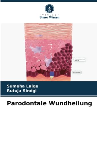 Parodontale Wundheilung: DE von Verlag Unser Wissen