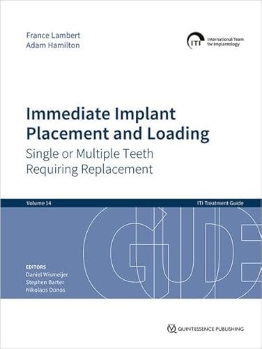 Immediate Implant Placement and Loading – Single or Multiple Teeth Requiring Replacement (ITI Treatment Guide Vol. 14) (ITI Treatment Guide Series (Engl.)) von Quintessence Publishing