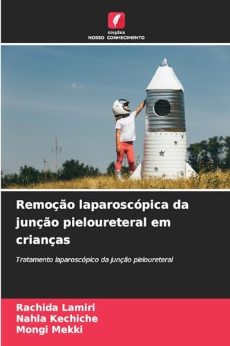 Remoção laparoscópica da junção pieloureteral em crianças: Tratamento laparoscópico da junção pieloureteral