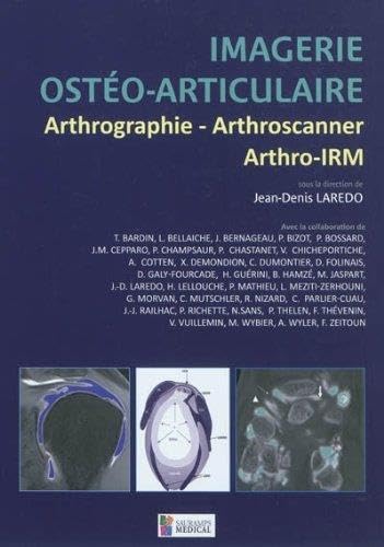 IMAGERIE OSTEO-ARTICULAIRE-ARTHROGRAPHIE,ARTHROSCANNER,ARTHRO-IRM