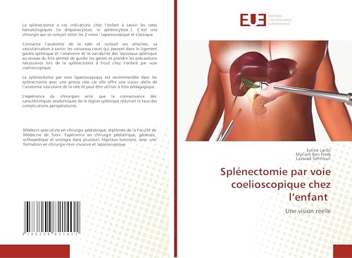 Splénectomie par voie coelioscopique chez l'enfant: Une vision réelle von Éditions universitaires européennes
