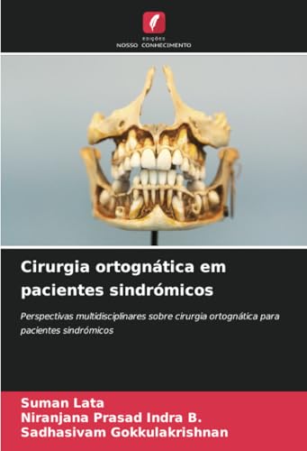 Cirurgia ortognática em pacientes sindrómicos: Perspectivas multidisciplinares sobre cirurgia ortognática para pacientes sindrómicos von Edições Nosso Conhecimento