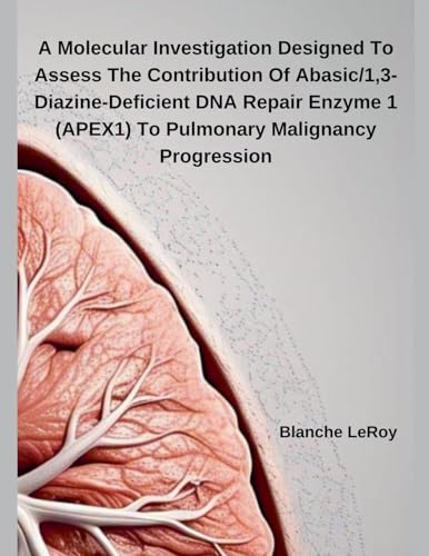 A Molecular Investigation Designed To Assess The Contribution Of Abasic/1,3-Diazine-Deficient DNA Repair Enzyme 1 (APEX1) To Pulmonary Malignancy Progression von Independent Publisher