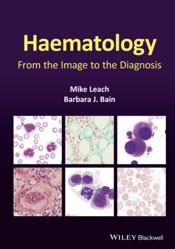 Haematology: From the Image to the Diagnosis von Wiley-Blackwell