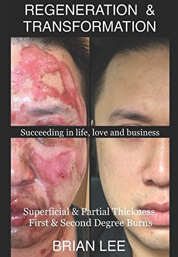 REGENERATION & TRANSFORMATION: Superficial & Partial Thickness, First & Second Degree Burns von Independently published