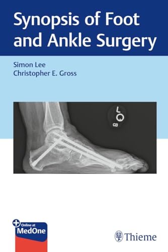 Synopsis of Foot and Ankle Surgery Synopsis of Foot and Ankle Surgery von Thieme Publishers New York