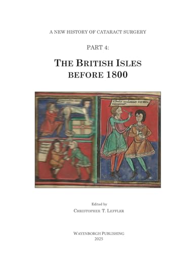 The History of Cataract Surgery: The British Isles before 1800 (A New History of Cataract Surgery, Band 4) von Kugler Publications