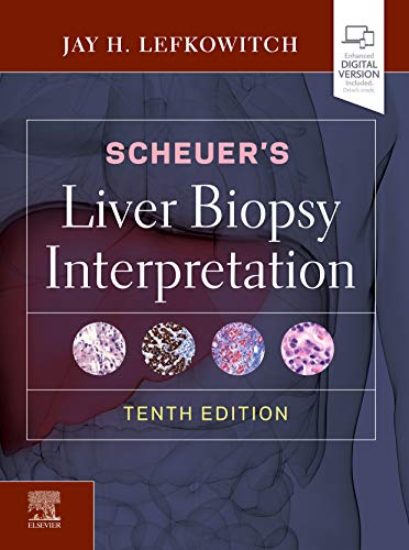Scheuer's Liver Biopsy Interpretation von Elsevier
