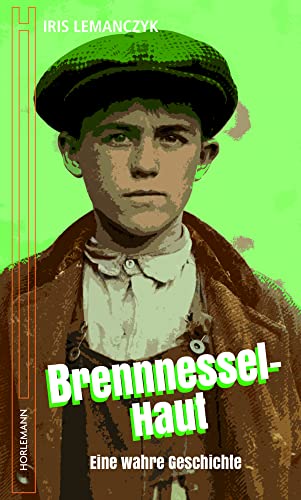 Brennnessel Haut: Eine wahre Geschichte