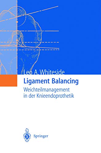 Ligament Balancing: Weichteilmanagement in der Knieendoprothetik von Springer