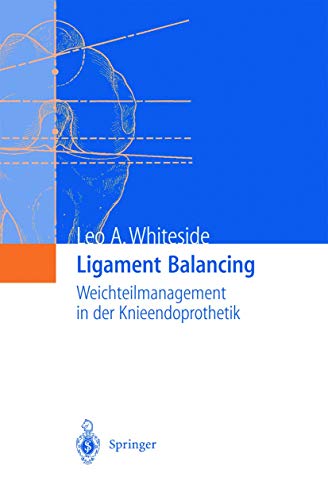 Ligament Balancing: Weichteilmanagement in der Knieendoprothetik von Springer