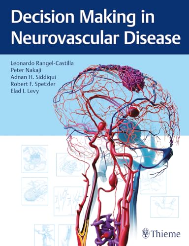 Decision Making in Neurovascular Disease von Thieme Medical Publishers