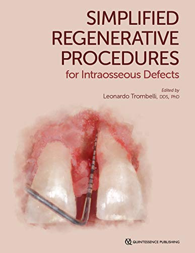 Simplified Regenerative Procedures for Intraosseous Defects von Quintessence Publishing (IL)