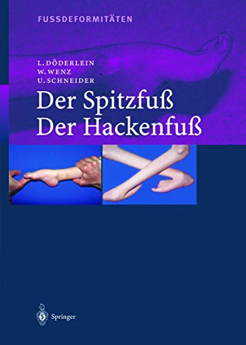 Fussdeformitäten: Der Spitzfuss/Der Hackenfuss von Springer