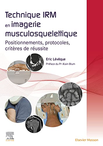 Technique IRM en imagerie musculosquelettique: Positionnements, protocoles, critères de réussite von MASSON