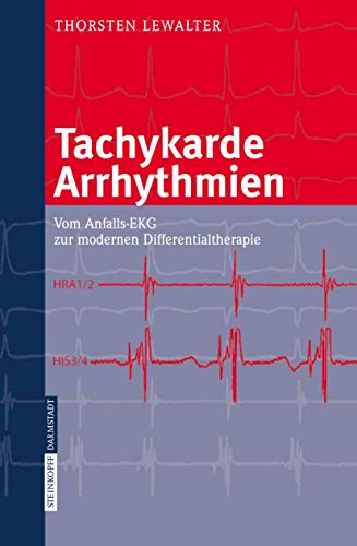 Tachykarde Arrhythmien: Vom Anfalls-EKG zur modernen Differentialtherapie