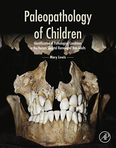 Paleopathology of Children: Identification of Pathological Conditions in the Human Skeletal Remains of Non-Adults