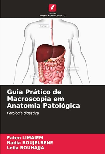 Guia Prático de Macroscopia em Anatomia Patológica: Patologia digestiva Guia Prático de Macroscopia em Anatomia Patológica: Patologia digestiva von Edições Nosso Conhecimento