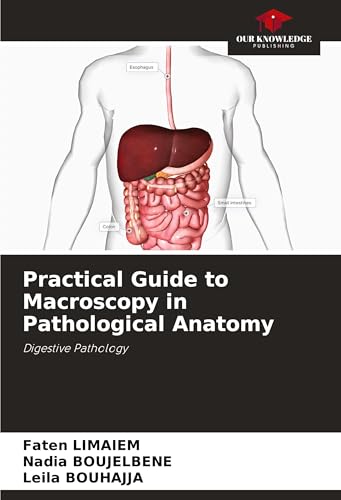 Practical Guide to Macroscopy in Pathological Anatomy: Digestive Pathology Practical Guide to Macroscopy in Pathological Anatomy: Digestive Pathology von Our Knowledge Publishing