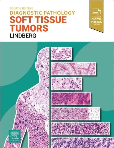 Diagnostic Pathology: Soft Tissue Tumors von Elsevier
