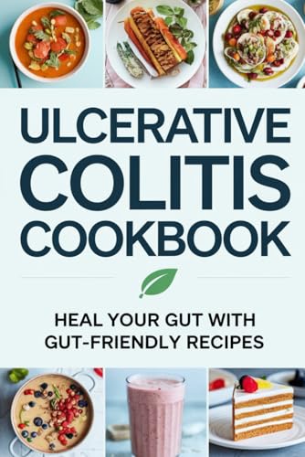 Ulcerative Colitis Cookbook von Independently published