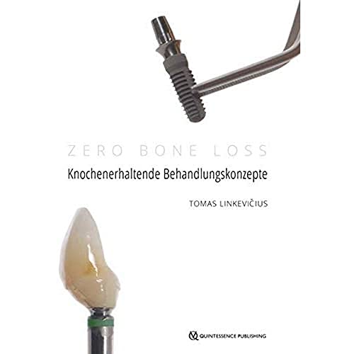 Zero Bone Loss: Knochenerhaltende Behandlungskonzepte von Quintessenz Verlags-GmbH
