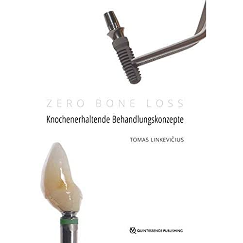 Zero Bone Loss: Knochenerhaltende Behandlungskonzepte von Quintessenz Verlag