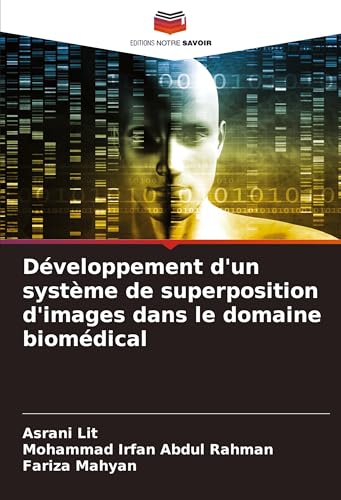 Développement d'un système de superposition d'images dans le domaine biomédical von VDM Verlag