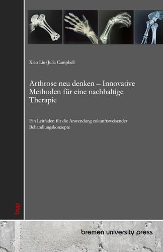 Arthrose neu denken – Innovative Methoden für eine nachhaltige Therapie: Ein Leitfaden für die Anwendung zukunftsweisender Behandlungskonzepte von bremen university press