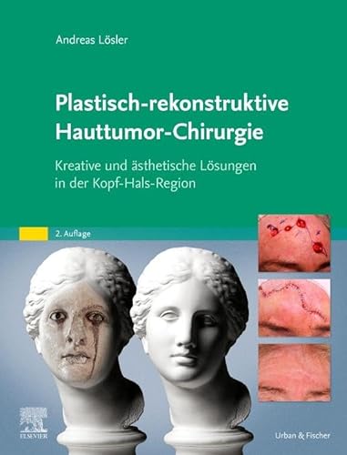 Plastisch-rekonstruktive Hauttumor-Chirurgie: Kreative und ästhetische Lösungen in der Kopf-Hals-Region von Urban & Fischer Verlag/Elsevier GmbH