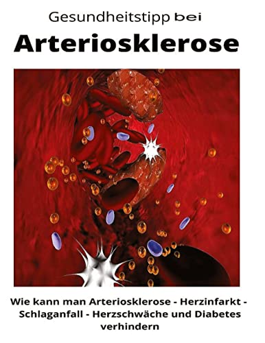 Gesundheitstipp bei Arteriosklerose: Wie kann man Arteriosklerose – Herzinfarkt – Schlaganfall - Herzschwäche und Diabetes verhindern von tredition
