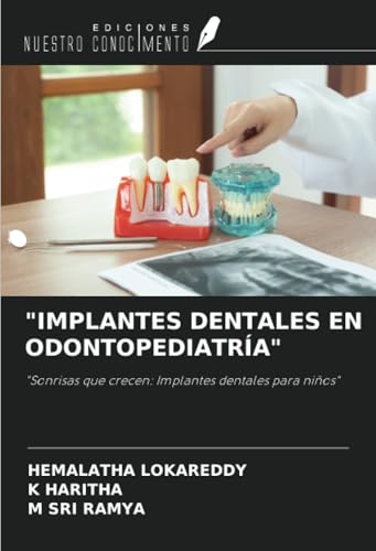 "IMPLANTES DENTALES EN ODONTOPEDIATRÍA": "Sonrisas que crecen: Implantes dentales para niños" von Ediciones Nuestro Conocimiento
