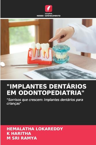 "IMPLANTES DENTÁRIOS EM ODONTOPEDIATRIA": "Sorrisos que crescem: Implantes dentários para crianças" von Edições Nosso Conhecimento