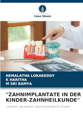 "ZAHNIMPLANTATE IN DER KINDER-ZAHNHEILKUNDE": "Lächeln, das wächst: Zahnimplantate für Kinder" von Verlag Unser Wissen