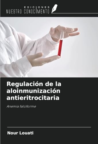 Regulación de la aloinmunización antieritrocitaria: Anemia falciforme