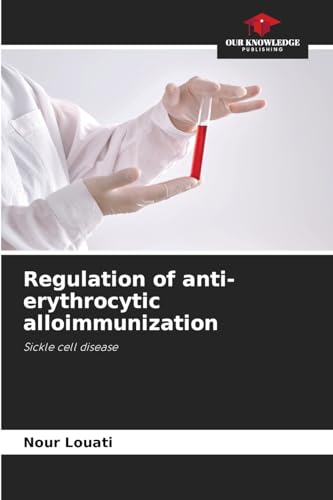 Regulation of anti-erythrocytic alloimmunization: Sickle cell disease von Our Knowledge Publishing